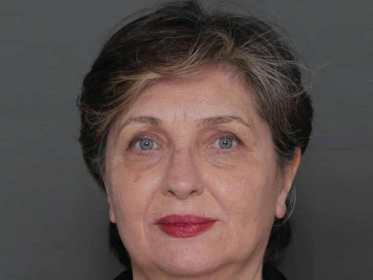 Соссан Фаррохниа