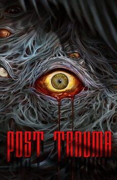 Post Trauma