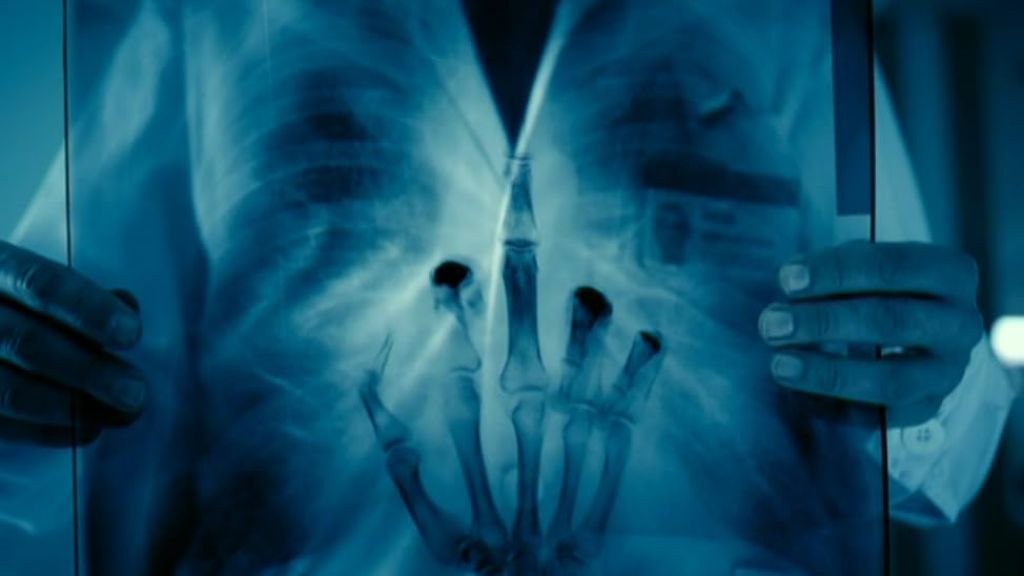 Интерны S02 E53