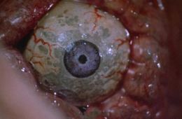 Франкеншлюха