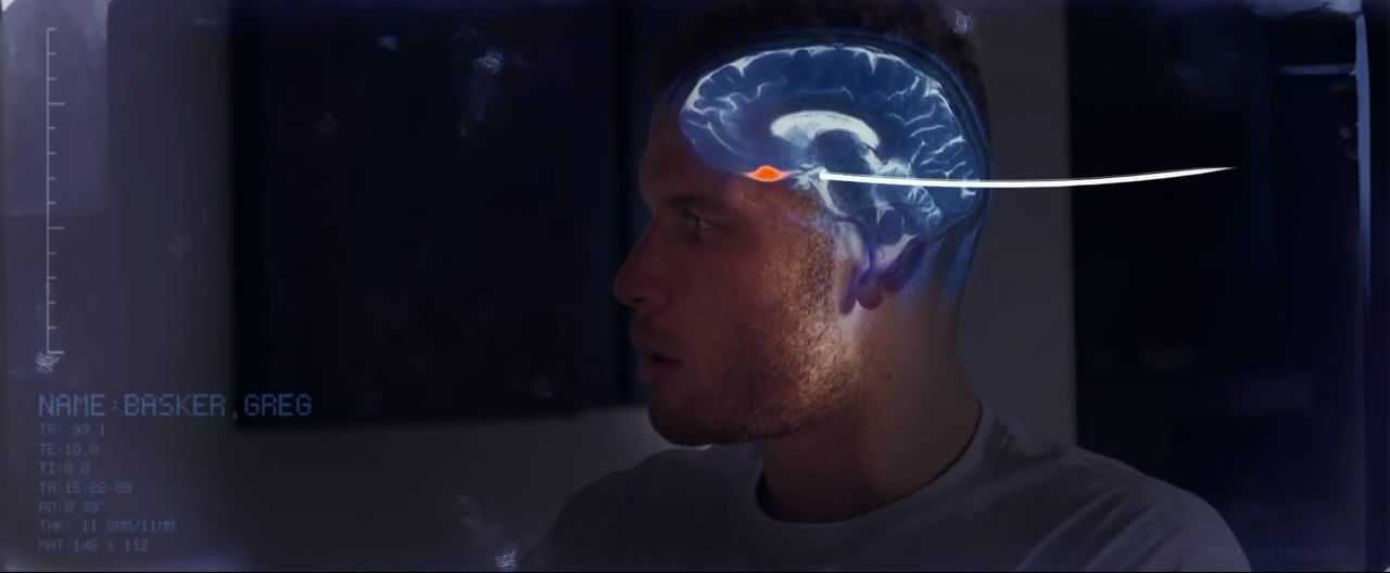 Женский мозг